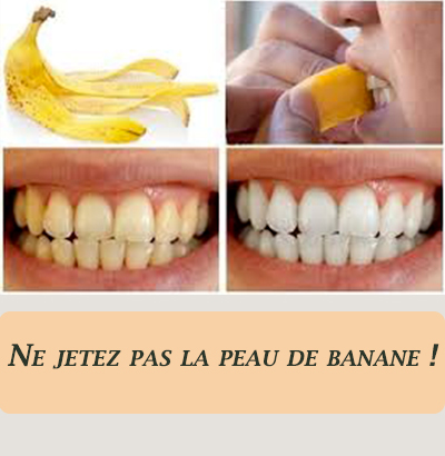 Ne jetez pas la peau de banane !