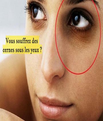 Si vous avez des cernes de manière plus ou moins permanente et que vous voulez vraiment vous en débarrasser, ces conseils peuvent vous être très utiles.