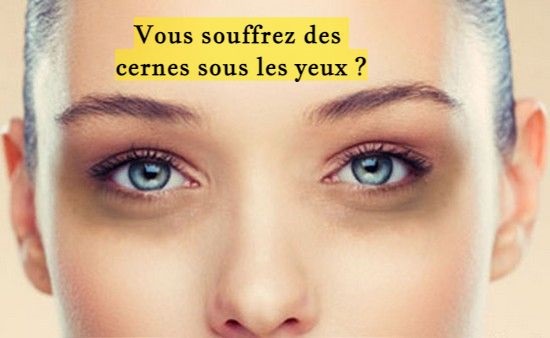 Vous souffrez des cernes sous les yeux ?