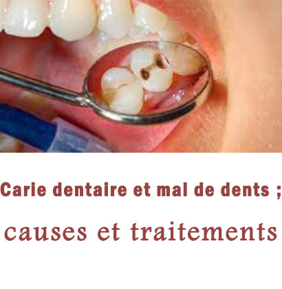 Carie dentaire et mal de dents; causes et traitements 