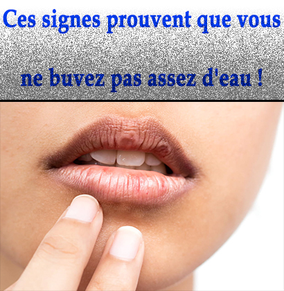 Ces signes prouvent que vous ne buvez pas assez d'eau !