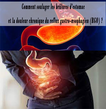Comment soulager les brûlures d’estomac et la douleur chronique du reflux gastro-œsophagien (RGO) ?