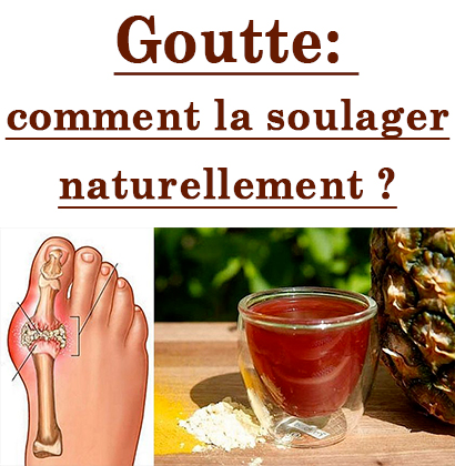 Goutte: comment la soulager naturellement ?