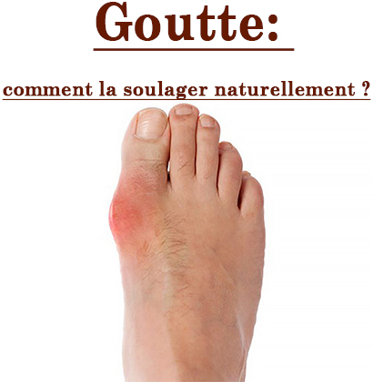 Goutte: comment la soulager naturellement ?