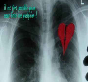 Peut-être que vous avez entendu parler d'une personne qui meurt d'un cœur brisé et vous avez pensé qu'une telle description n'est que figurative.