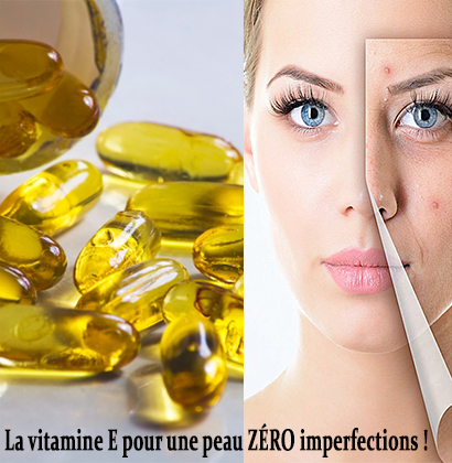 La vitamine E pour une peau ZÉRO imperfections !