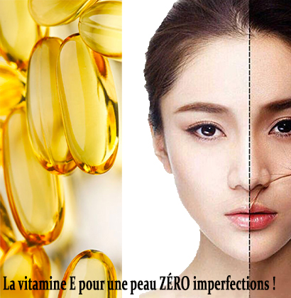 La vitamine E pour une peau ZÉRO imperfections !