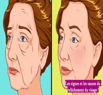 Le relâchement du visage est la conséquence d'une perte d'élasticité de la peau et de l'affaiblissement des muscles faciaux.