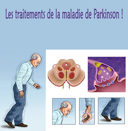 Les traitements de la maladie de Parkinson !