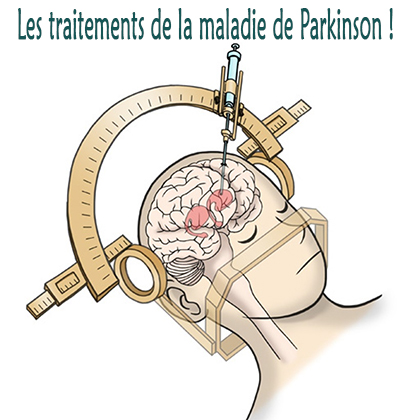 Les traitements de la maladie de Parkinson !