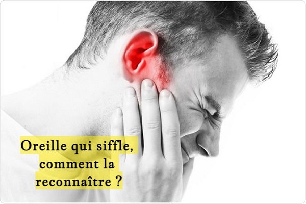 Oreille qui siffle, comment la reconnaître ?