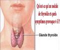 Très courant, le nodule thyroïdien est une grosseur qui se forme dans la thyroïde. Dans la majorité des cas, le nodule ne donne lieu à aucun symptôme et cette affection est bénigne. La présence d'un nodule de la thyroïde est plus répandue chez les femmes et sa fréquence augmente avec l’âge, ou dans certains contextes.