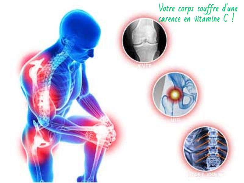 Votre corps souffre d'une carence en vitamine C