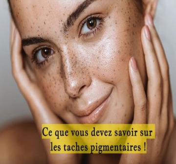 Les taches pigmentaires : certains pensent qu’elles sont jolies et uniques alors que d’autres préfèreraient s’en débarrasser définitivement.