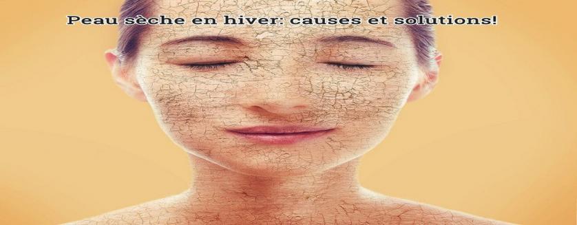 Peau sèche en hiver: causes et solutions!