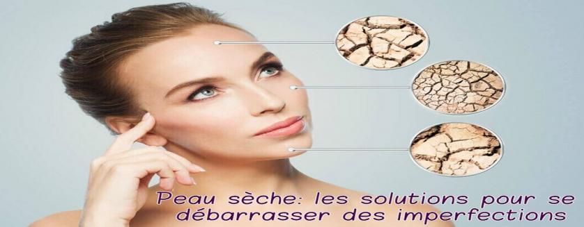 Peau sèche: les solutions pour se débarrasser des imperfections